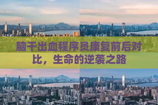 脑干出血程序员康复前后对比，生命的逆袭之路